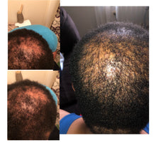 Load image into Gallery viewer, Bserene Hair Growth Oil Sample